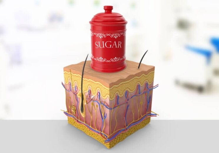 Effects of Sugar on the Skin 1 Sugar Skin